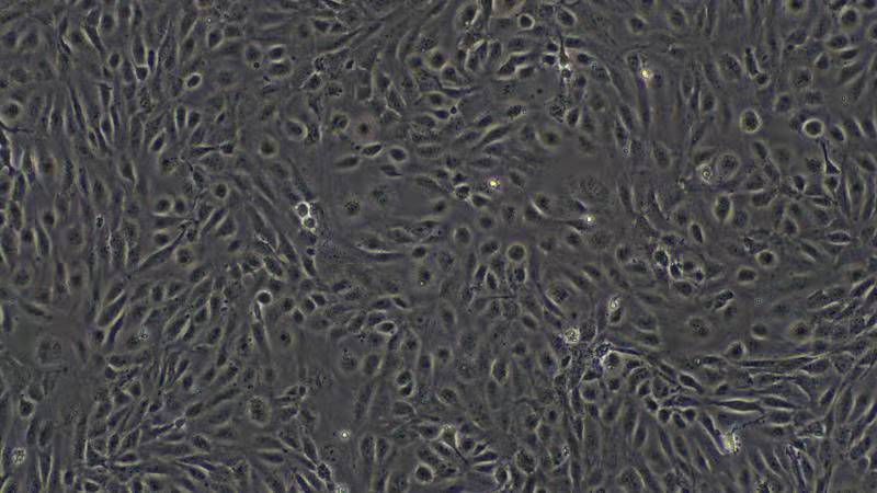 NCI-H1299人肺腺癌细胞