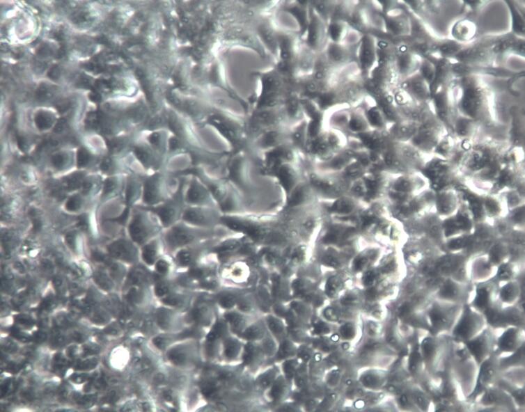 M14人黑色素瘤细胞