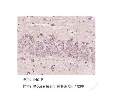 SGC-7901人胃癌细胞
