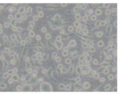WI-38人胚肺成纤维细胞