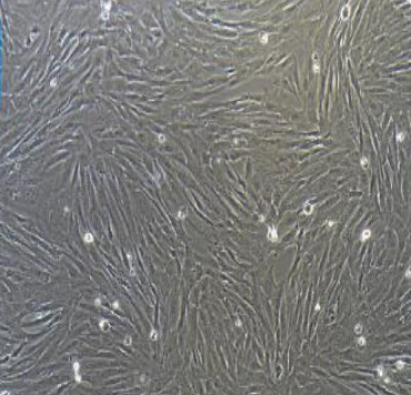 NCI-H1688肺癌细胞人经典小细胞