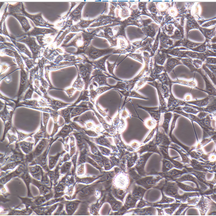 人肝癌索拉非尼耐药株SMMC-7721/Sorafenib