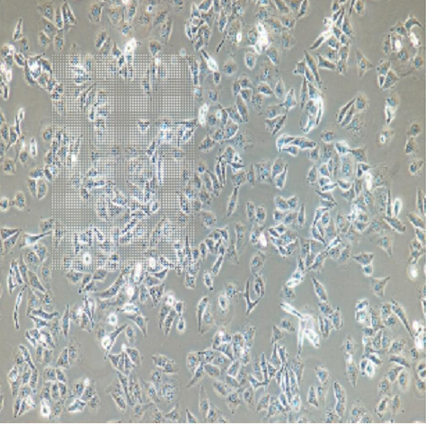 株TPC-1人甲状腺乳头状癌细胞