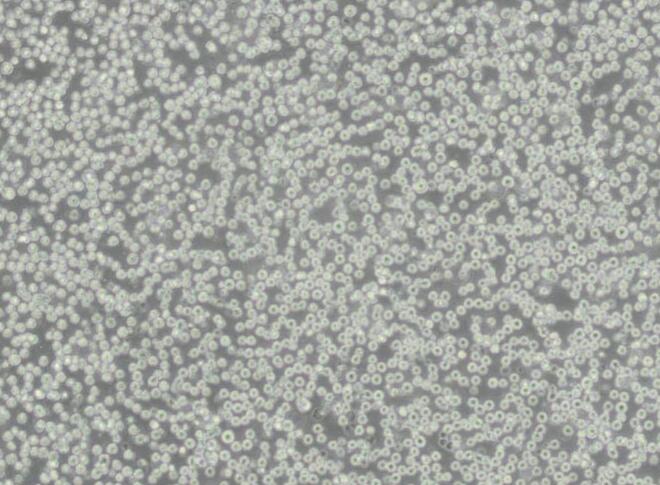 NOMO-1人急性单核细胞白血病细胞