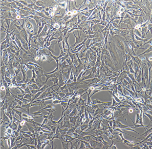 HCV-p7中国仓鼠卵巢癌细胞