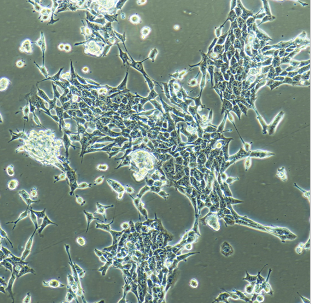 HCV-NS3中国仓鼠卵巢癌细胞