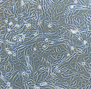 纺锤形贴壁MEMMDA-MB-435S人乳腺导管癌细胞