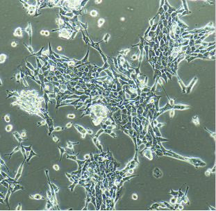 SF-295成纤维细胞人XG恶性胶质瘤细胞