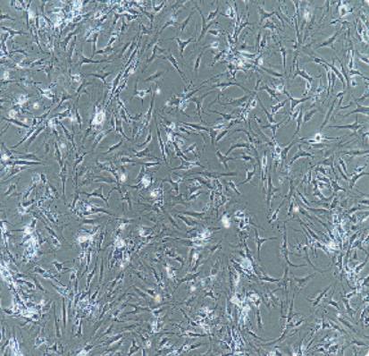 Karpas-299人间变性大细胞淋巴瘤细胞