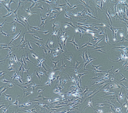 癌间皮瘤(肺原发)NCI-H226肋膜积腋(转移)鳞细胞