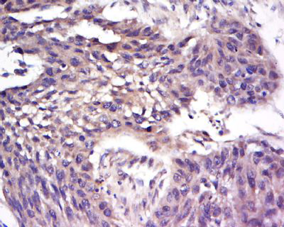 CCRF-CEM白血病细胞人急性淋巴细胞