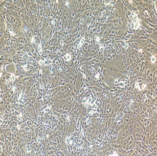 HCC-827肺癌细胞人非小细胞