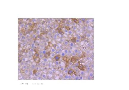 SV40转化COS-7非洲绿猴肾细胞