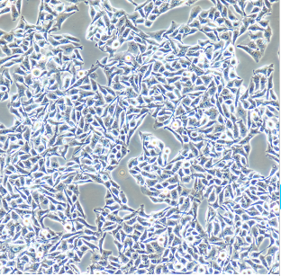 绿色标记MDA-MB-231-GFP人乳腺癌细胞