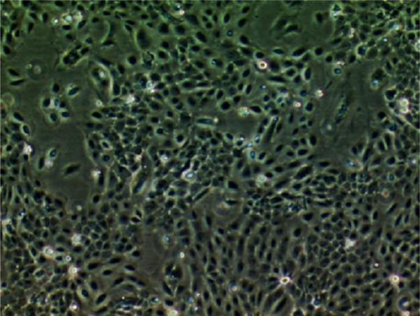 YD-38人肺鳞状细胞癌