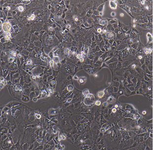 SW1573人肺泡细胞癌细胞