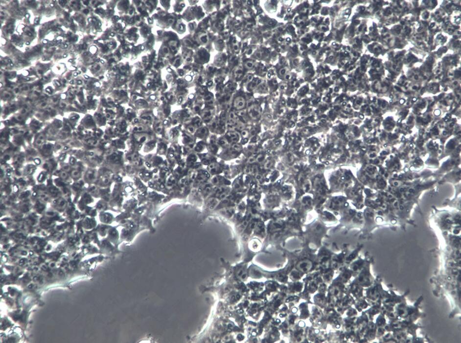 CEM-T4人急性T淋巴细胞白血病细胞