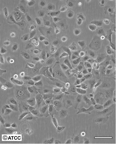 RWPE-2(BHS)人前列腺正常细胞