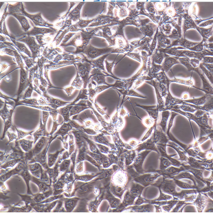 HL-60人早幼粒急性白血病细胞