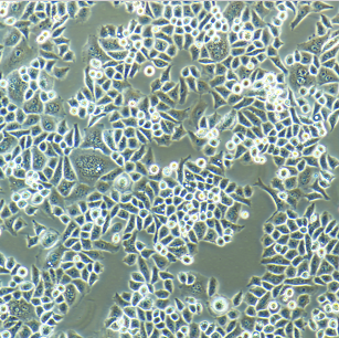 RBL-1大鼠嗜碱性粒细胞性白血病细胞