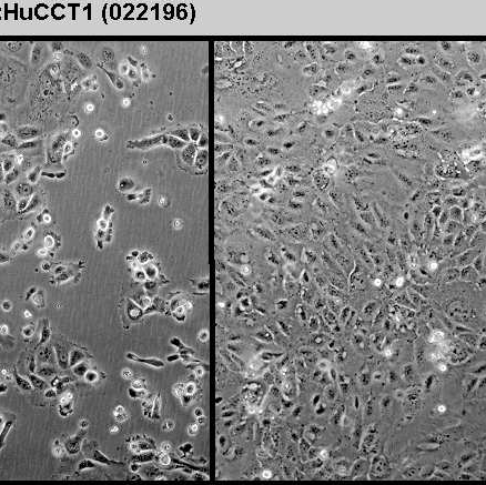 HHCC人肝癌细胞