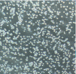 NCI-BL1339人B淋巴细胞