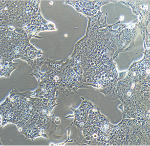 NCI-H2286人肺癌细胞