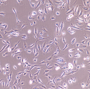 NCI-H1435人非小细胞肺癌细胞