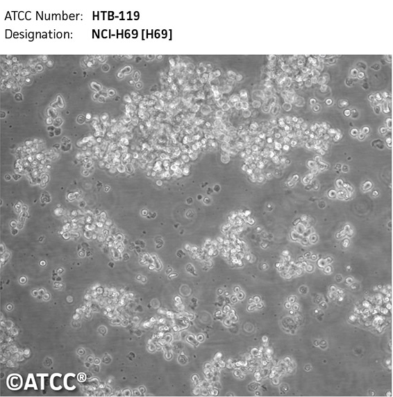 CHP-212人脑神经母瘤细胞