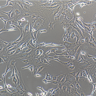 SCC-9人类鳞状上皮舌癌细胞