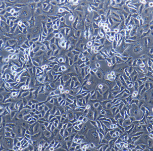 SW579人甲状腺鳞癌细胞