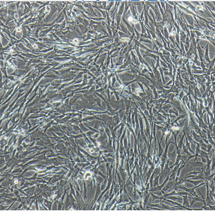 ECC12人子宫内膜癌细胞