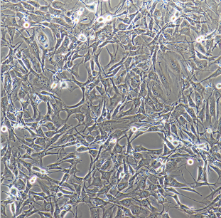 ECC10人子宫内膜癌细胞