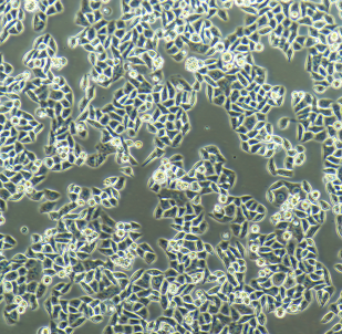 FTC-133人甲状腺癌细胞