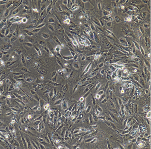 SU-DHL-1弥漫性组织淋巴瘤细胞