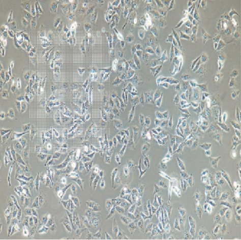 ML-2人急性髓单核细胞白血病细胞
