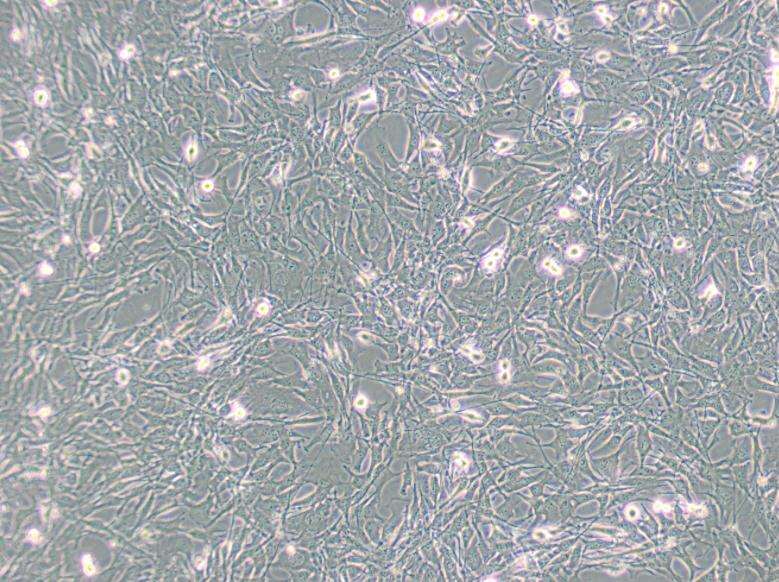 HOCF人脉络膜成纤维细胞