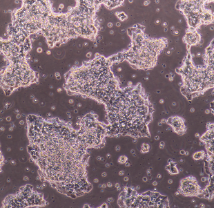 SBC-3人小细胞肺癌细胞