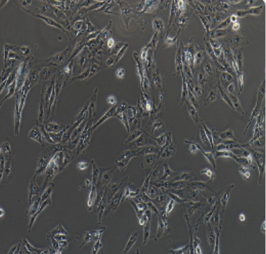 Caki-1人肾透明细胞癌皮肤转移细胞