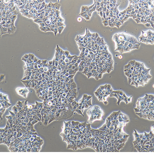 Granta-519人类B细胞株淋巴癌细胞