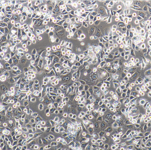 SACC-83涎腺腺样囊性癌细胞