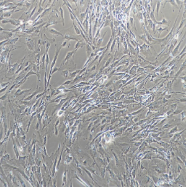 LK2人肺鳞癌细胞