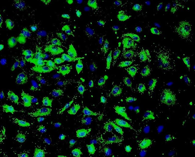 大鼠胰腺星状原代细胞
