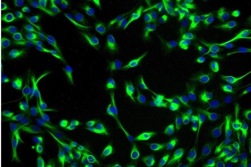 大鼠视网膜神经节原代细胞