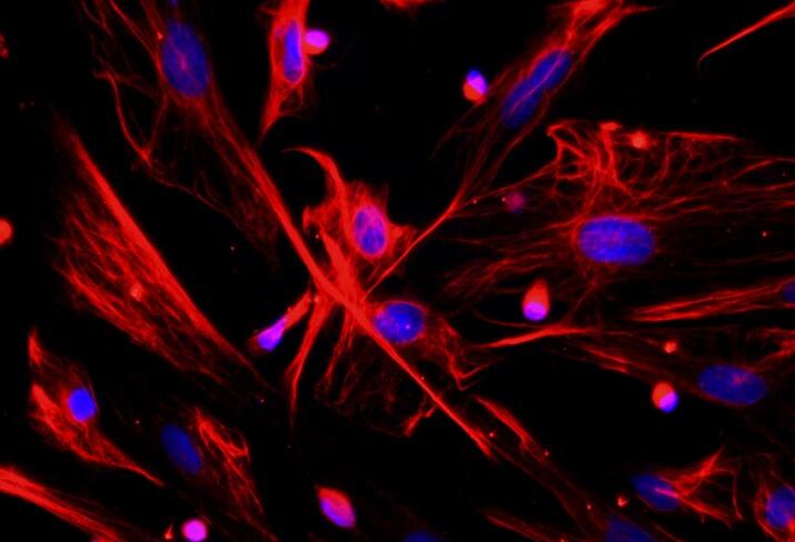 大鼠前列腺成纤维原代细胞