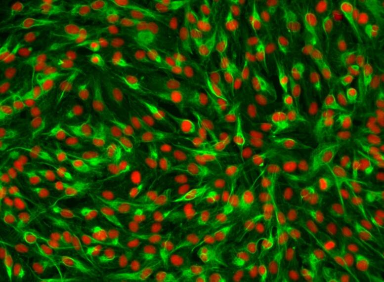 大鼠小脑星形胶质原代细胞