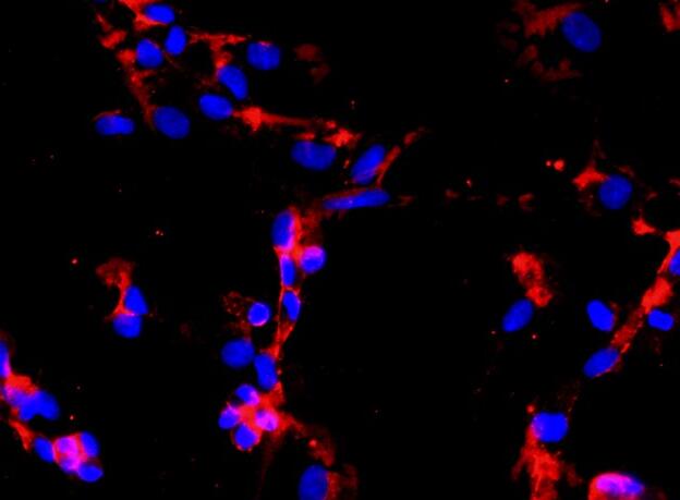 人肾癌组织源原代细胞