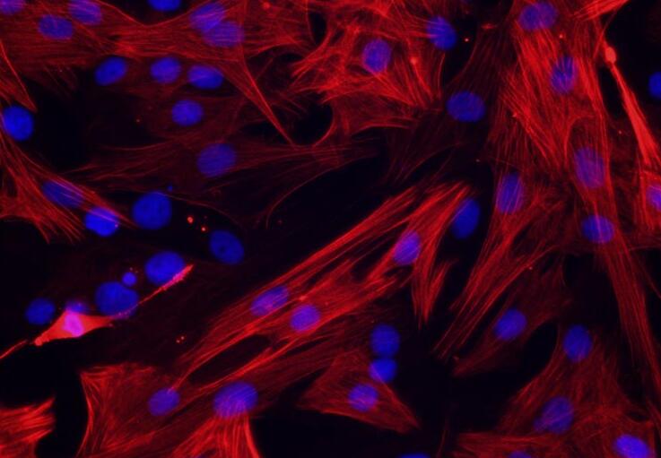 人胆道癌组织源原代细胞