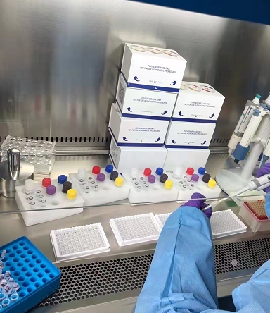 人细胞纤维连接蛋白(cFn)Elisa试剂盒