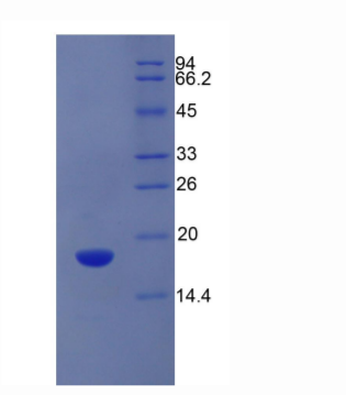 溶质载体家族3成员2(SLC3A2)重组蛋白